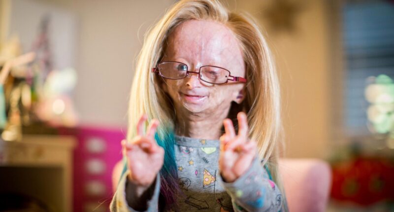 Is Adalia Rose Dead or Alive? What Happened To Her? Death Cause - Did She Died From Condition Progeria Syndrome