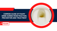 Common Cause of Foamy Urine During Menstruation: Prevention and Treatment
