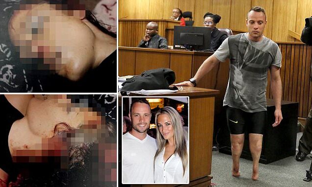 Reeva Steenkamp Cause Of Death: How Many Times Did Oscar Pistorius Shoot His GF?