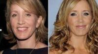 Has Felicity Huffman had Plastic Surgery? Before And After
