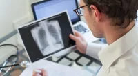 Evolution of Tuberculosis: New Insights and Facts