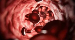 Preventing Blood Clots Naturally Without Medication