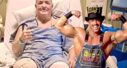 Buff Bagwell Undergoes Leg Amputation After Car Accident Injuries